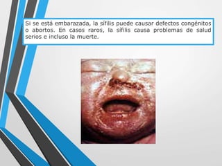 Si se está embarazada, la sífilis puede causar defectos congénitos
o abortos. En casos raros, la sífilis causa problemas de salud
serios e incluso la muerte.
 