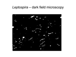 Leptospira – dark field microscopy
 