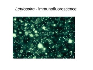 Leptospira - immunofluorescence
 