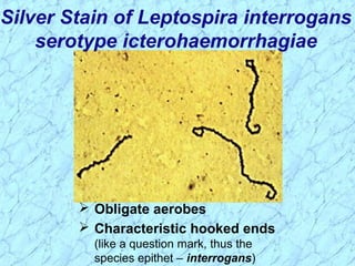Silver Stain of Leptospira interrogans
serotype icterohaemorrhagiae
 Obligate aerobes
 Characteristic hooked ends
(like a question mark, thus the
species epithet – interrogans)
 