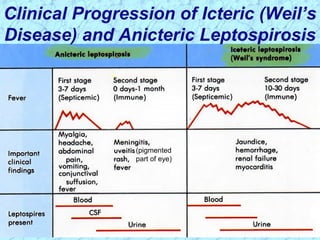 Clinical Progression of Icteric (Weil’s
Disease) and Anicteric Leptospirosis
(pigmented
part of eye)
 