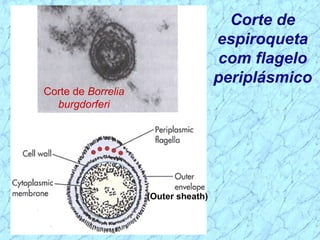 Corte de
espiroqueta
com flagelo
periplásmico
(Outer sheath)
Corte de Borrelia
burgdorferi
 