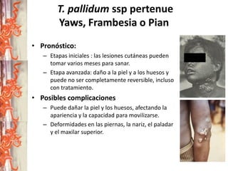 T. pallidum ssp pertenue
Yaws, Frambesia o Pian
• Pronóstico:
– Etapas iniciales : las lesiones cutáneas pueden
tomar varios meses para sanar.
– Etapa avanzada: daño a la piel y a los huesos y
puede no ser completamente reversible, incluso
con tratamiento.

• Posibles complicaciones
– Puede dañar la piel y los huesos, afectando la
apariencia y la capacidad para movilizarse.
– Deformidades en las piernas, la nariz, el paladar
y el maxilar superior.

 