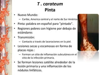 T . carateum
Pinta
• Nuevo Mundo:
– Caribe, America central y el norte de Sur América.

• Pinta: palabra en español para "pintado".
• Regiones pobres con higiene por debajo de
estándares
• Transmisión:
– Contacto a través de laceraciones en la piel.

• Lesiones secas y escamosas en forma de
placas rojas :
– Forman un sitio de inflamación subcutánea en el
sitio de la infección primaria.

• Se forman lesiones satélite alrededor de la
lesión primaria y una inflamación de los
nódulos linfáticos.

 