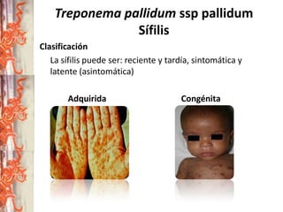 Treponema pallidum ssp pallidum
Sífilis
Clasificación
La sífilis puede ser: reciente y tardía, sintomática y
latente (asintomática)
Adquirida

Congénita

 