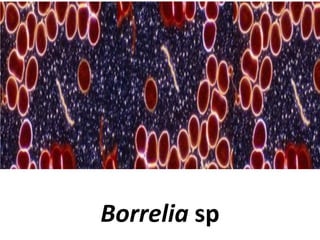 Borrelia sp

 