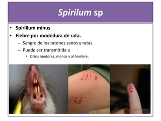 Spirilum sp
• Spirillum minus
• Fiebre por modedura de rata.
– Sangre de los ratones sanos y ratas
– Puede ser transmitida a
• Otros roedores, monos y al hombre.

 