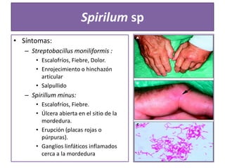 Spirilum sp
• Síntomas:
– Streptobacillus moniliformis :
• Escalofríos, Fiebre, Dolor.
• Enrojecimiento o hinchazón
articular
• Salpullido

– Spirillum minus:
• Escalofríos, Fiebre.
• Úlcera abierta en el sitio de la
mordedura.
• Erupción (placas rojas o
púrpuras).
• Ganglios linfáticos inflamados
cerca a la mordedura

 