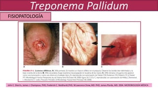 FISIOPATOLOGÍA
Treponema Pallidum
John C. Sherris, James J. Champoux, PHD, Frederick C. Neidhardt,PHD, W.Lawrance Drew, MD. PHD, James.Plorde, MD. 2004. MICROBIOLOGÍA MÉDICA
 