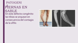 PATOGENI
A
PIERNAS EN
SABLE
En este defecto congénito
las tibias se arquean en
consecuencia del contagio
de la sífilis
 