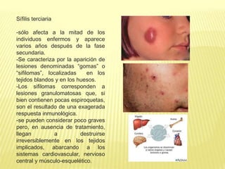 Sífilis terciaria
-sólo afecta a la mitad de los
individuos enfermos y aparece
varios años después de la fase
secundaria.
-Se caracteriza por la aparición de
lesiones denominadas “gomas” o
“sifilomas”, localizadas en los
tejidos blandos y en los huesos.
-Los sifilomas corresponden a
lesiones granulomatosas que, si
bien contienen pocas espiroquetas,
son el resultado de una exagerada
respuesta inmunológica.
-se pueden considerar poco graves
pero, en ausencia de tratamiento,
llegan a destruirse
irreversiblemente en los tejidos
implicados, abarcando a los
sistemas cardiovascular, nervioso
central y músculo-esquelético.
 