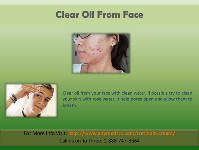 Tretinoin cream