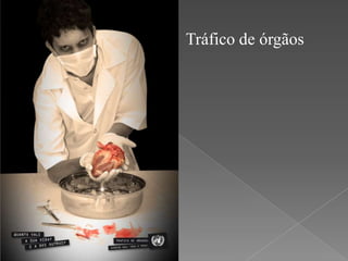 Tráfico de órgãos

 