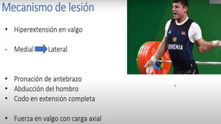 FRACTURAS DE ESCAPULA
Epidemiología
• Representa el 1% del total de fracturas, el 5% de las fracturas de la cintura escapular.
•
Cuando compromete la fosa glenoidea se aproxima al 10%.
• La mayoría por Traumas de gran energía
• Mayor incidencia en pacientes con 35 - 45 años , y tiene lesiones asociadas en un 90%.
• Proyección AP verdadera de hombro, escapula en Y , proyección axilar de hombro.
 