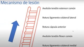 TRATAMIENTO ORTOPEDICO
FRACTURA DEL CUERPO FRACTURA DEL CUELLO FRACTURA DE LA CAVIDAD
GLENOIDES
No requiere reducción Hielo 24
horas, vendaje compresivo y
cabestrillo, retirar a las 2, 3
semanas e iniciar terapia física
No requiere reducción, para
evitar Mayores
desplazamientos
inmovilizamos el hombro
con un vendaje de yeso tipo
Velpeau, para luego de 3 a 4
semanas iniciar rehabilitación.
Desplazamiento mínimo: No
requiere reducción
Inmovilización con
cabestrillo durante 3 a 4
semanas y luego terapia
física
EL TRATAMIENTO ES CONSERVADOR ANTE FRACTURAS POCO DESPLAZADAS Y
ESTABLES.
 