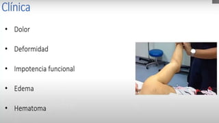 Luxación de hombro (Tracciones) Maniobra de Hipócrates
I. Se debe realizar bajo anestesia
general.
II. Con el paciente en decúbito
supino.
III. Se realiza una tracción
longitudinal de la extremidad
inferior en ligera abducción
colocando el talón del pie
haciendo fulcro en la ingle del
paciente.
 