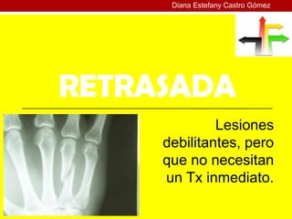Diana Estefany Castro Gómez




RETRASADA
              Lesiones
     debilitantes, pero
     que no necesitan
     un Tx inmediato.
 