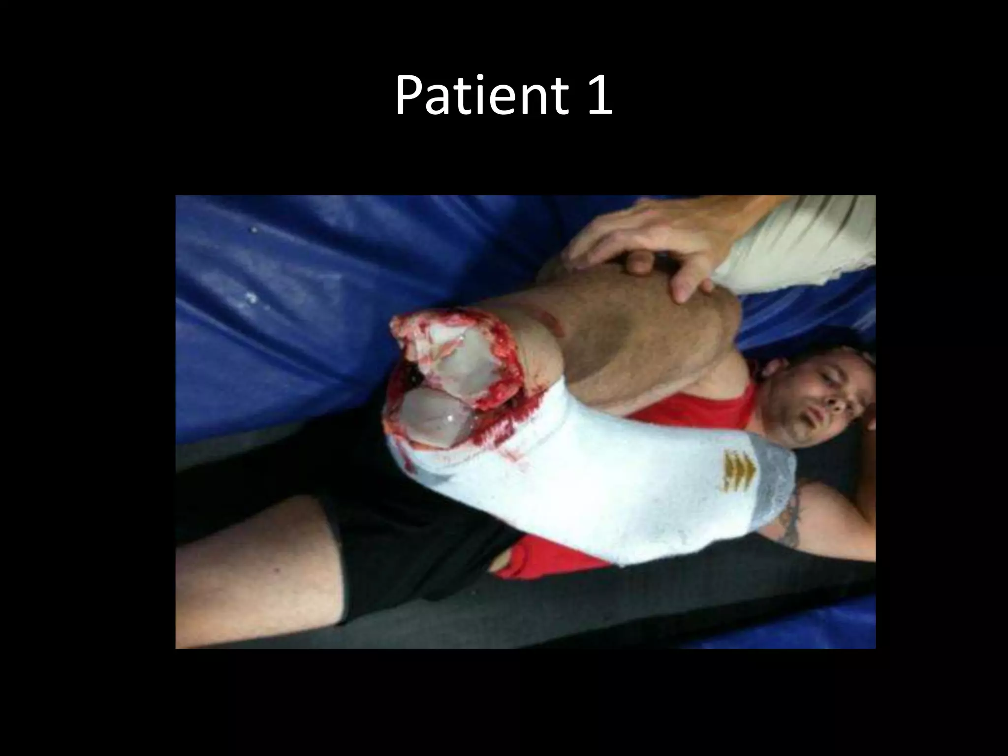 Patient 1
 