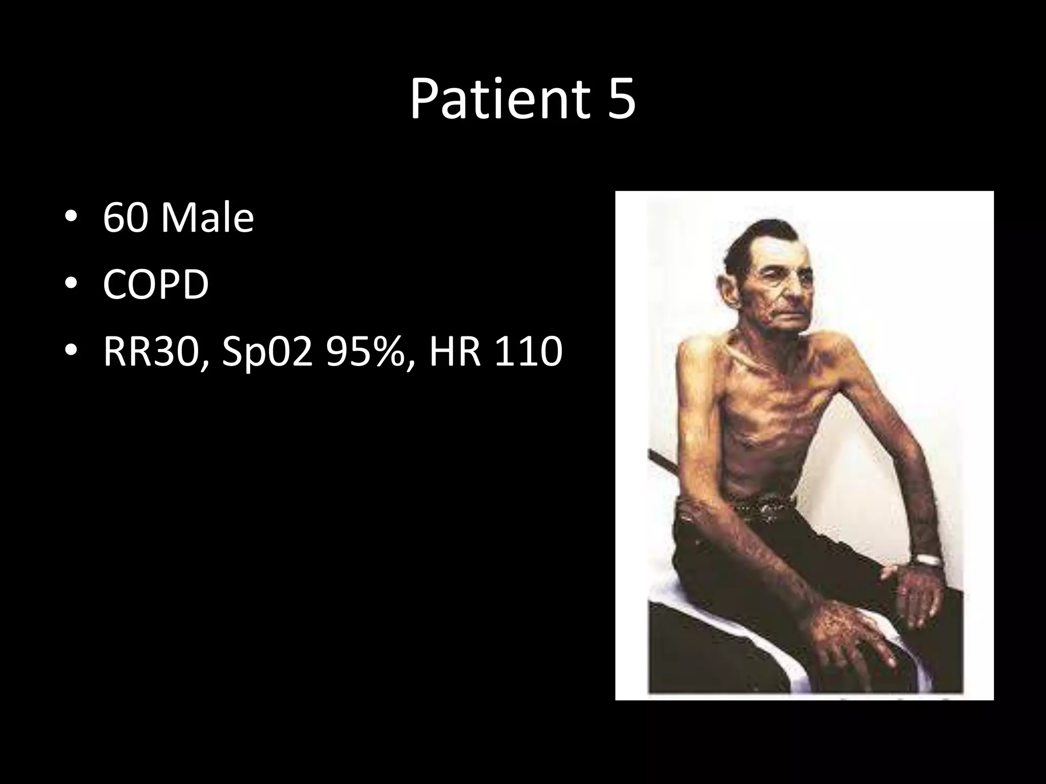Patient 5
• 60 Male
• COPD
• RR30, Sp02 95%, HR 110
 