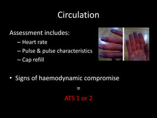 Circulation
Assessment includes:
– Heart rate
– Pulse & pulse characteristics
– Cap refill
• Signs of haemodynamic compromise
=
ATS 1 or 2
 
