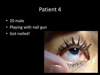 Patient 4
• 20 male
• Playing with nail gun
• Got nailed!
 