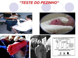 “ TESTE DO PEZINHO” 