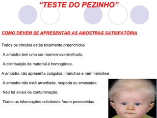 “ TESTE DO PEZINHO” COMO DEVEM SE APRESENTAR AS AMOSTRAS SATISFATÓRIA Todos os círculos estão totalmente preenchidos A amostra tem uma cor marrom-avermelhado.  A distribuição de material é homogênea. A amostra não apresenta coágulos, manchas e nem hemólise . A amostra não está arranhada, raspada ou amassada. Não há sinais de contaminação. Todas as informações solicitadas foram preenchidas. 