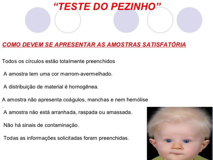 Triagem neonatal