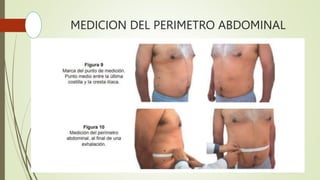 MEDICION DEL PERIMETRO ABDOMINAL
 