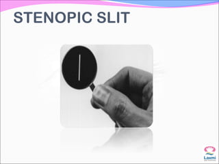 STENOPIC SLIT
 
