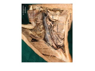 triangles of the neck | ppt Images High Quality Grahic TRIANGLES OF NECK, ent , anatomy, basics.pptx