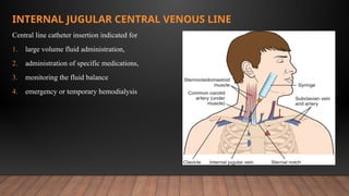 Comprehensive Overview of Neck Triangles in Oral & Maxillofacial ...