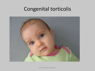 Congenital torticolis
DR NDAYISABA CORNEILLE
 