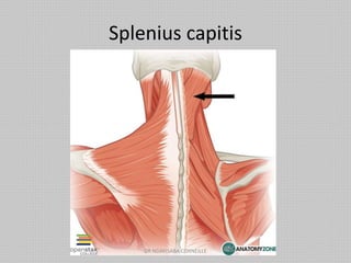 Splenius capitis
DR NDAYISABA CORNEILLE
 