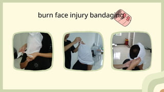 Proper Application of Triangular Bandage during Disaster | PPTX