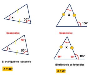50°
x
Desarrollo:
X = 80°
El triángulo es isósceles
x
100°
Desarrollo:
50°
x
100°80° 80°
El triángulo es isósceles
X = 20°
 