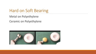 Hard on Soft Bearing
Metal on Polyethylene
Ceramic on Polyethylene
 