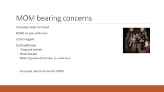 MOM bearing concerns
Increase metal ion level
ALVAL or pseudotumor
?Carcinogens
Contradictions
◦ Pregnant women
◦ Renal disease
◦ Metal hypersensitivity due to metal ions
◦ Increased rate of revision for MOM
 