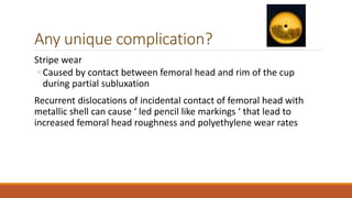 Any unique complication?
Stripe wear
◦ Caused by contact between femoral head and rim of the cup
during partial subluxation
Recurrent dislocations of incidental contact of femoral head with
metallic shell can cause ‘ led pencil like markings ‘ that lead to
increased femoral head roughness and polyethylene wear rates
 
