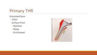 Primary THR
Cemented Stem
◦ Collar
◦ Surface finish
◦ Polished
◦ Matte
◦ Grit blasted
 