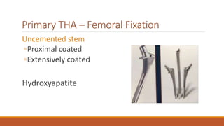 Primary THA – Femoral Fixation
Uncemented stem
◦Proximal coated
◦Extensively coated
Hydroxyapatite
 