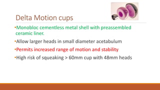 Delta Motion cups
•Monobloc cementless metal shell with preassembled
ceramic liner.
•Allow larger heads in small diameter acetabulum
•Permits increased range of motion and stability
•High risk of squeaking > 60mm cup with 48mm heads
 