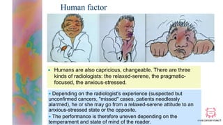 www.cancer-rose.fr
Human factor
■ Humans are also capricious, changeable. There are three
kinds of radiologists: the relax...