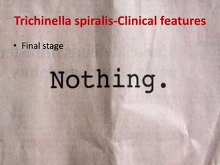 Trichinella spiralis-Clinical features
• Final stage
 
