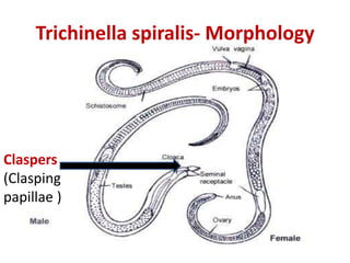 Trichinella spiralis- Morphology
Claspers
(Clasping
papillae )
 
