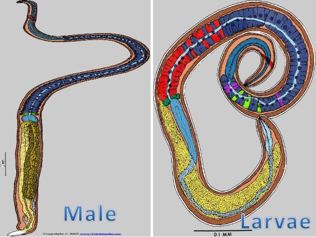 Trichinella spiralis