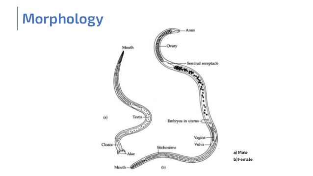 Trichinella Spiralis Diagram