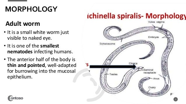 Trichinella spiralis