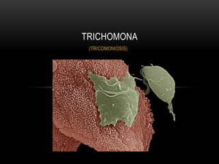 TRICHOMONA
 (TRICOMONIOSIS)
 