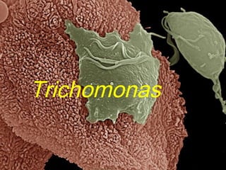 Trichomonas
 